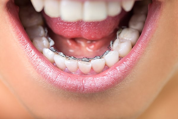 orthodontics201412