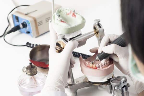 Can I Get Crown Placement on Dental Implants with Bone Loss?