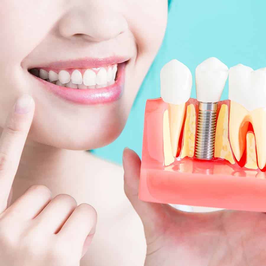 asha dental leawood ks Services Implant Supported Dentures Image