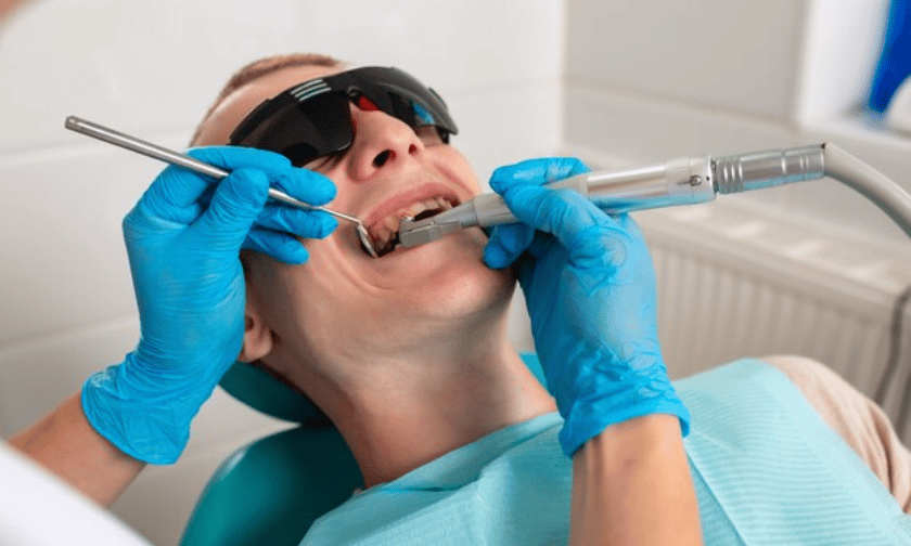 What Are The Myths About Dental Sealants Treatment?