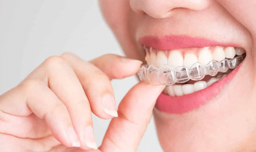 Invisalign Teen: Straighten Your Smile with Confidence and Convenience