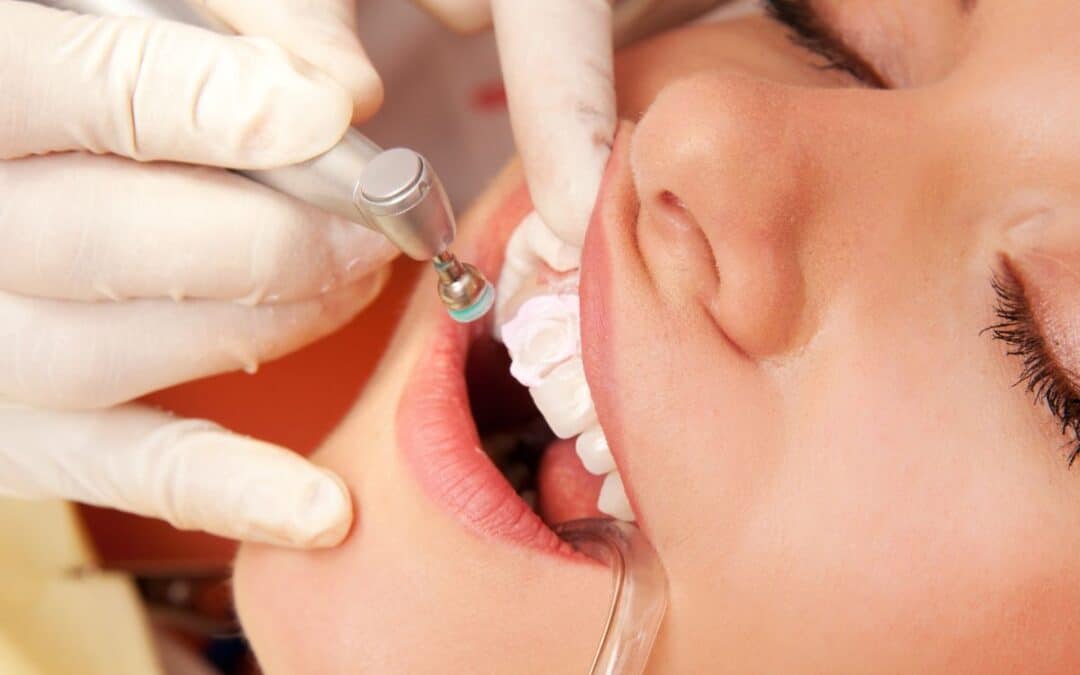 How Long Do Dental Crowns Last? Tips for Extending Their Lifespan