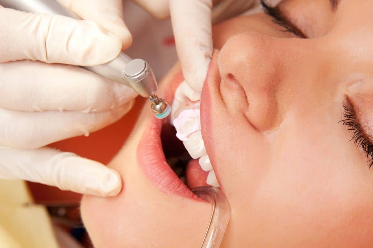 How Long Do Dental Crowns Last