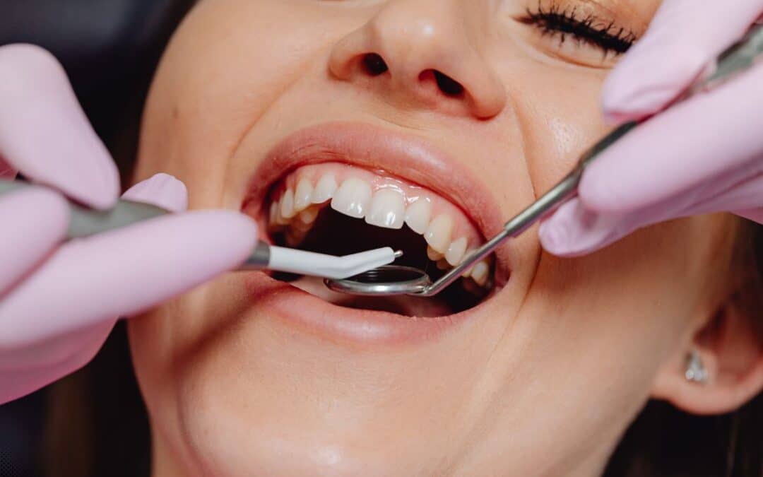 How Cosmetic Dentistry Can Fix Crooked Teeth Without Braces