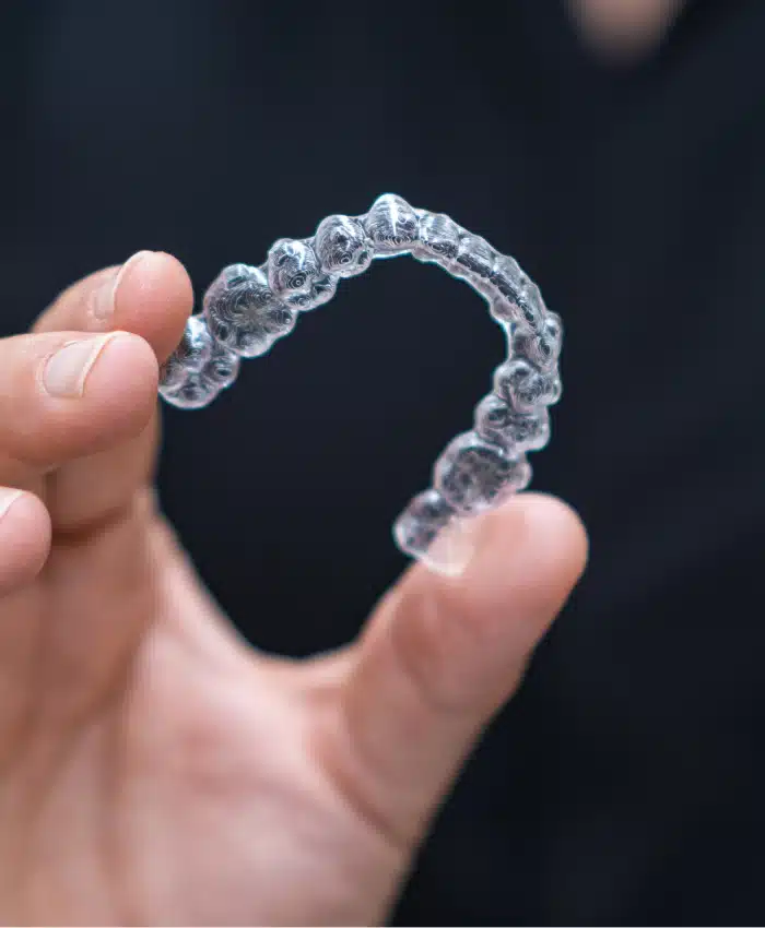 asha dental leawood ks Services Veneers Image