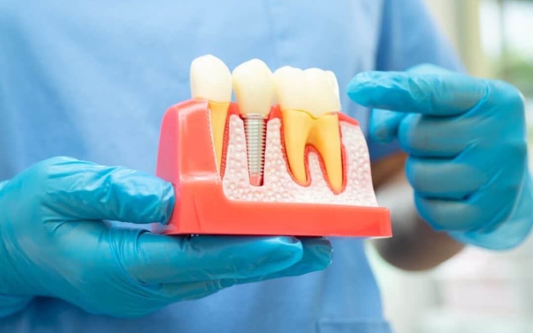 Finding the Right Dental Implant Dentist in Leawood: Key Factors to Consider