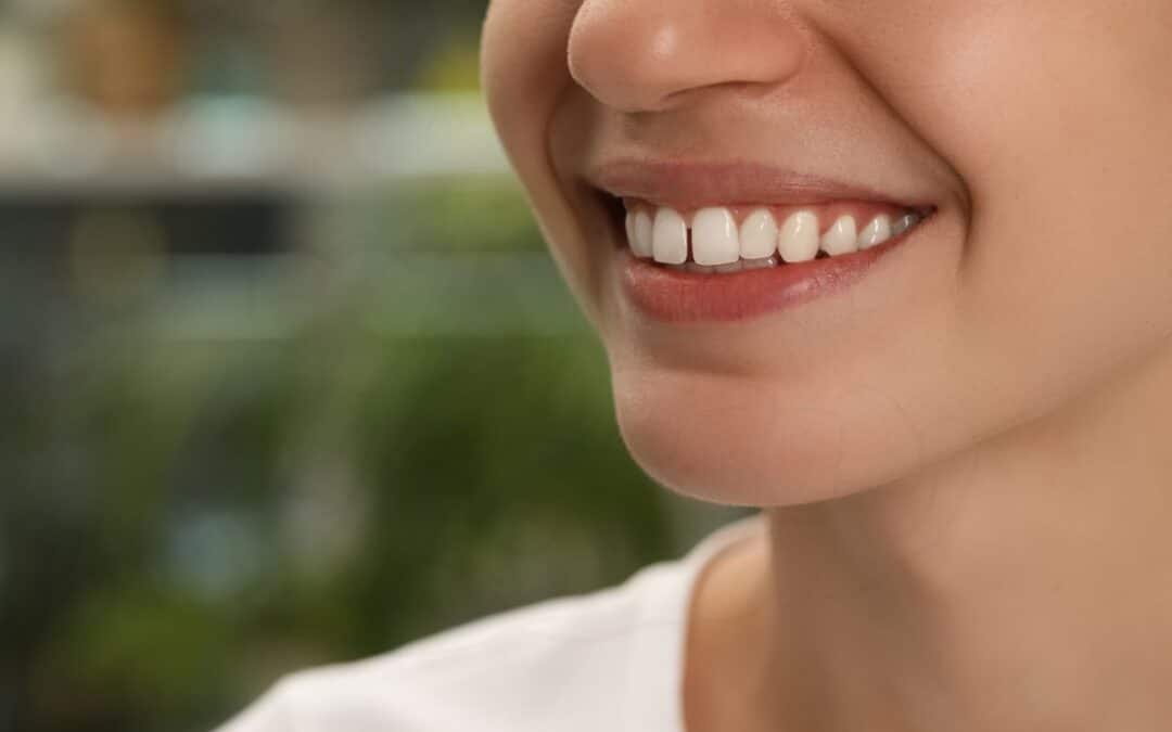 How To Fix A Gap Between Front Teeth: Expert Solutions For A Perfect Smile