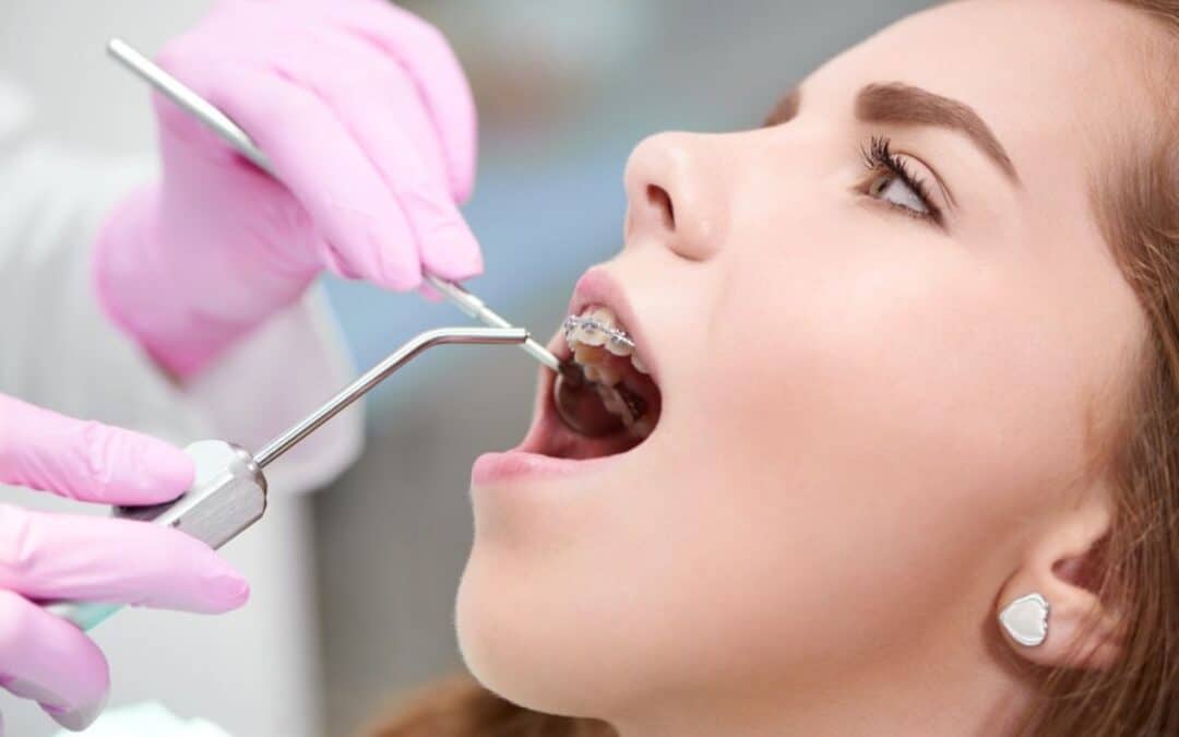 Top Cosmetic Dental Treatments for Chipped Teeth You Should Know