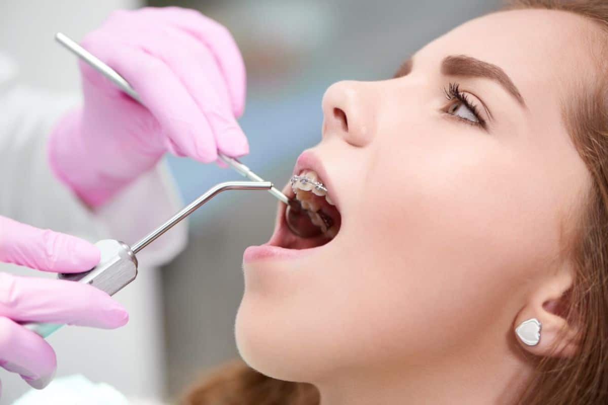 Cosmetic Dental Treatments for Chipped Teeth