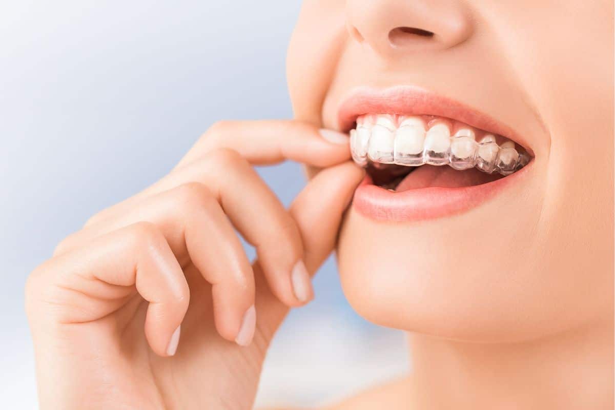 Does Invisalign Hurt