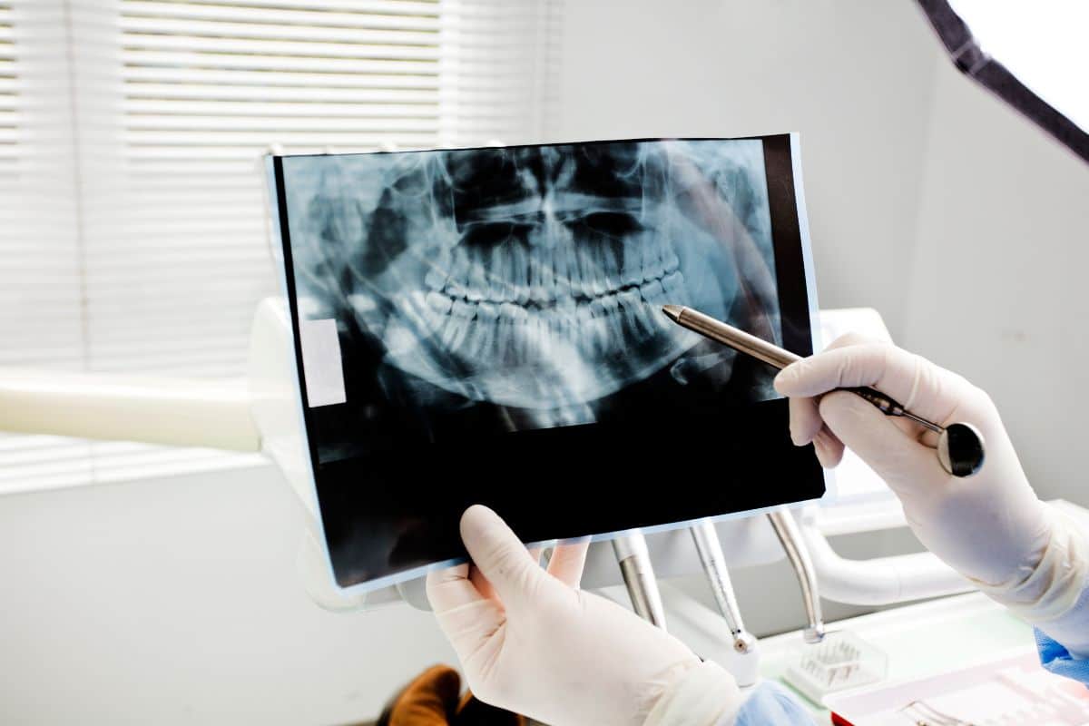 Can I Refuse Dental X-Rays Leawood