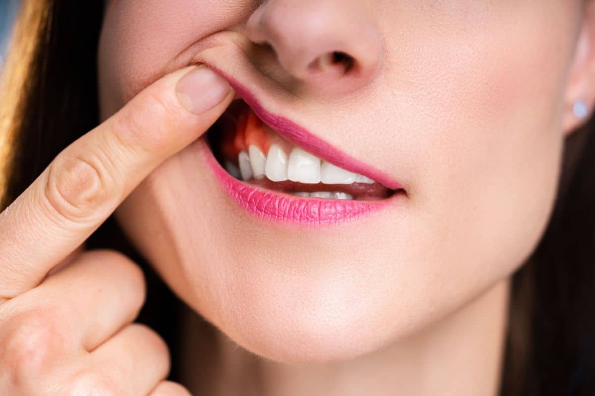 swelling around teeth