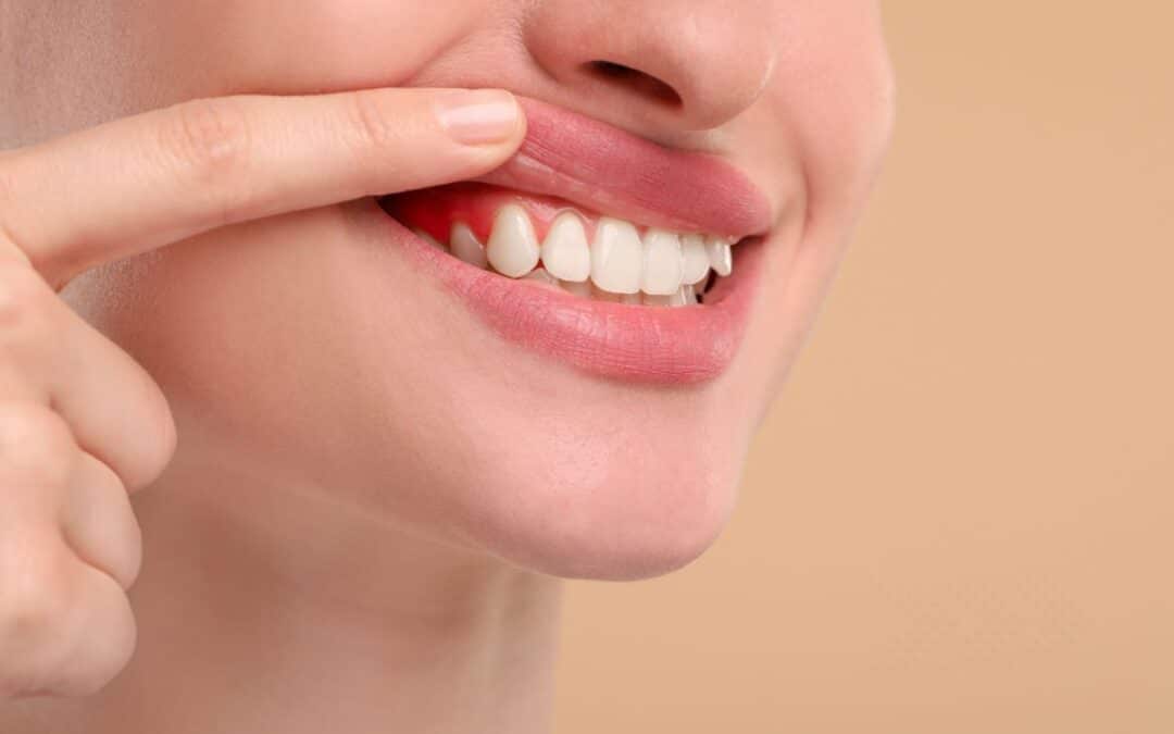 Early Signs of Gum Disease Most People Ignore in Overland Park