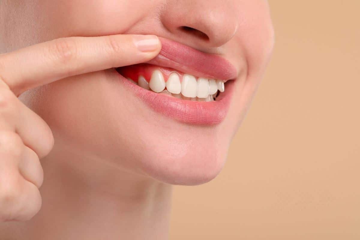 early-signs-gum-disease early-signs-gum-disease