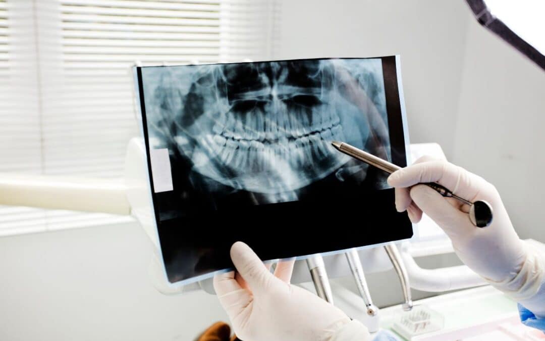 How Often Do You Really Need Dental X-Rays? A Dentist’s Honest Answer