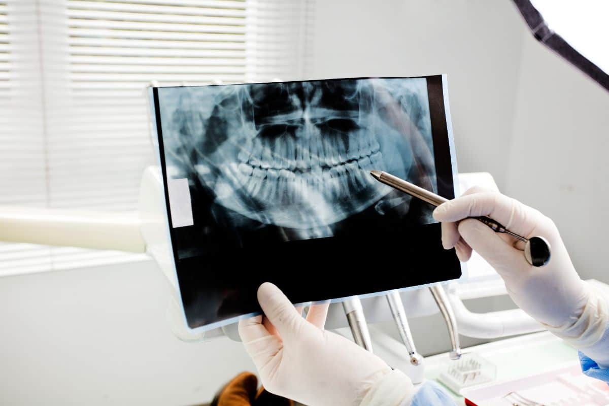 how-often-need-dental-x-rays