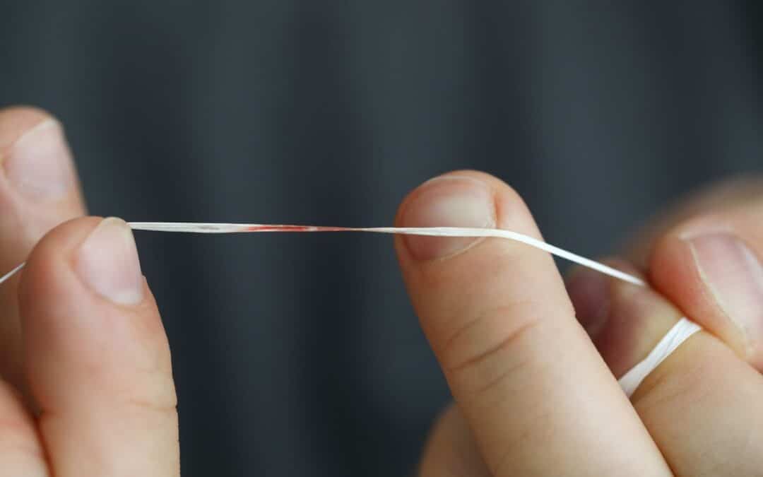 Why Your Gums Bleed When You Floss And When To Be Concerned