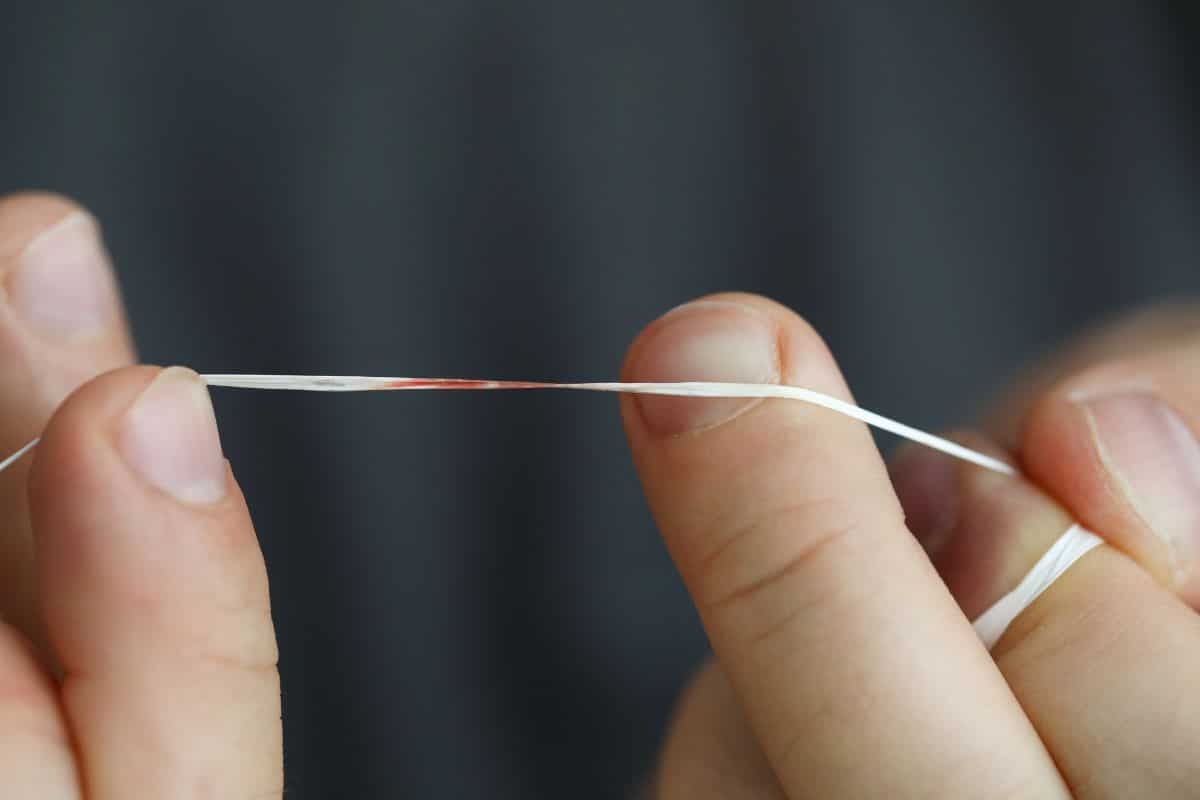 why-gums-bleed-when-flossing