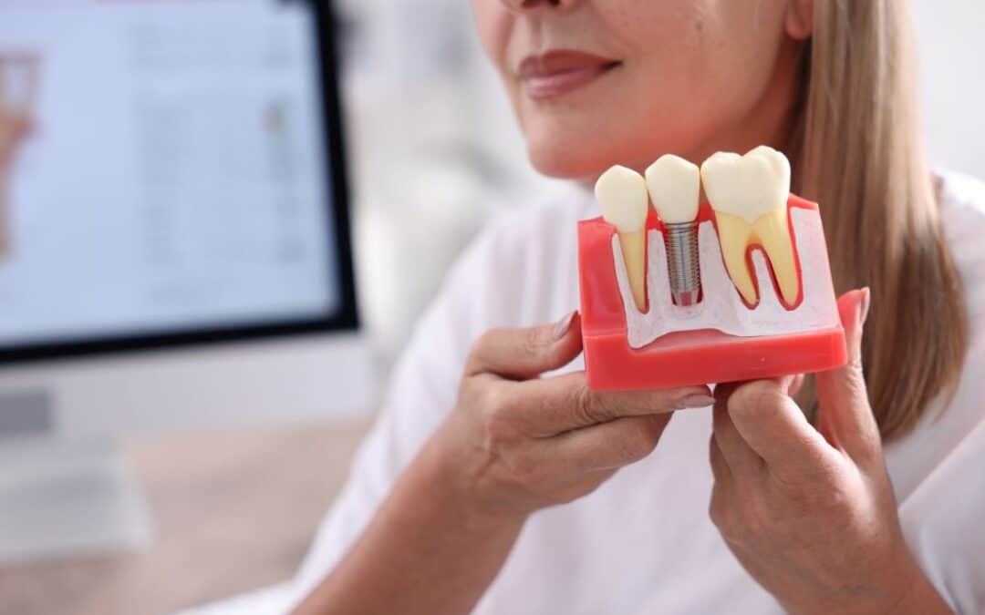 Dental Implants for Seniors: Is It Ever Too Late?